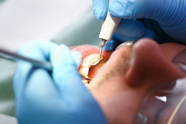 Best Knocked-Out Tooth Emergency  in Sugarcreek, OH